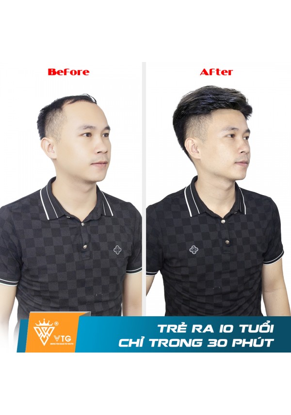 Tóc Giả Dạng Dán Che Hói Nam Cao Cấp - VTG D01